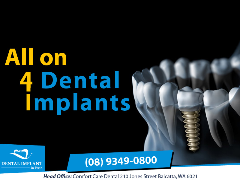 Dental Implant in Balcatta Perth – Dentist in Perth – All on 4 Dental Implant